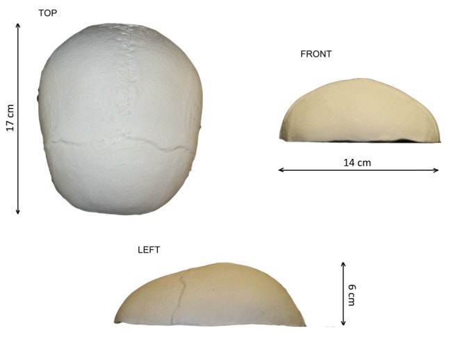 Standard Calvaria for X-Ray CT, US, MRI