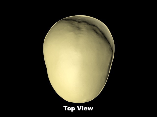Standard Calvaria for X-Ray CT, US, MRI
