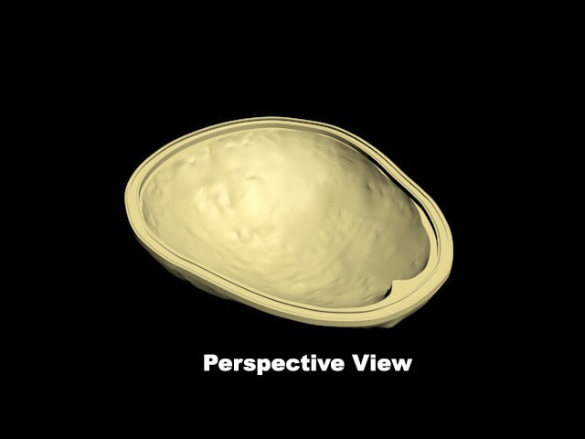 Standard Calvaria for X-Ray CT, US, MRI
