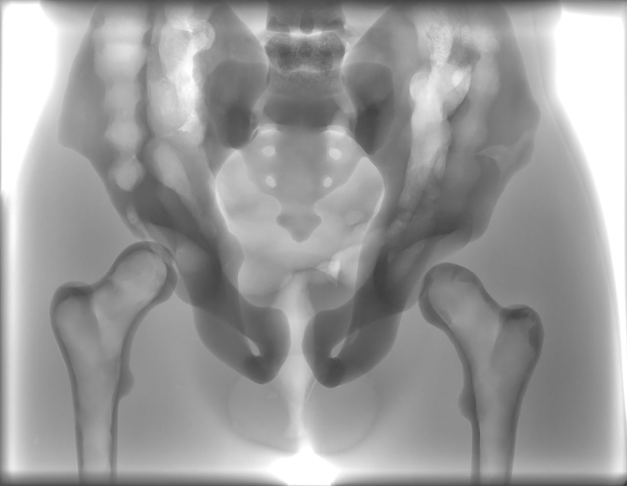 Adult Pelvis for X-Ray CT, US, MRI