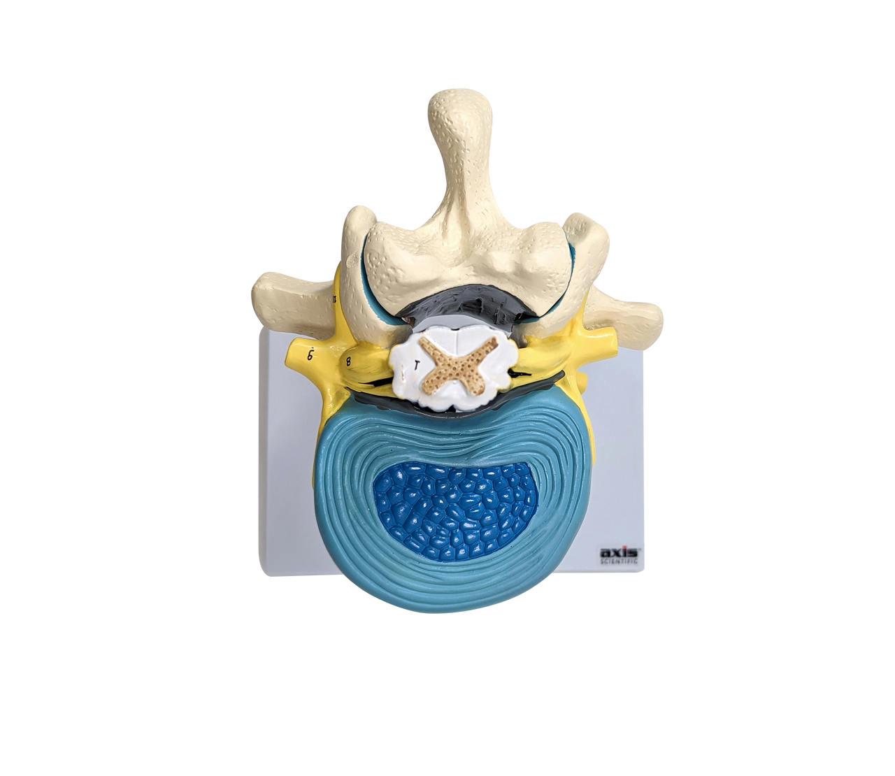 Axis Scientific Enlarged Lumbar Vertebrae with Spinal Cord and Nerves