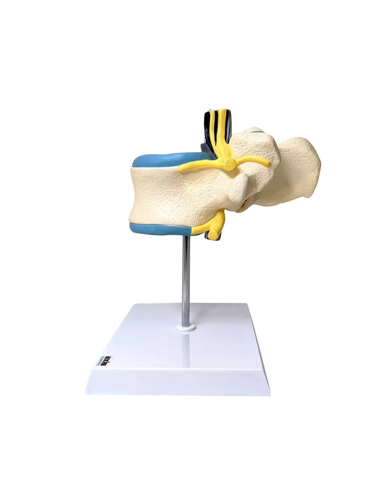 Axis Scientific Enlarged Lumbar Vertebrae with Spinal Cord and Nerves