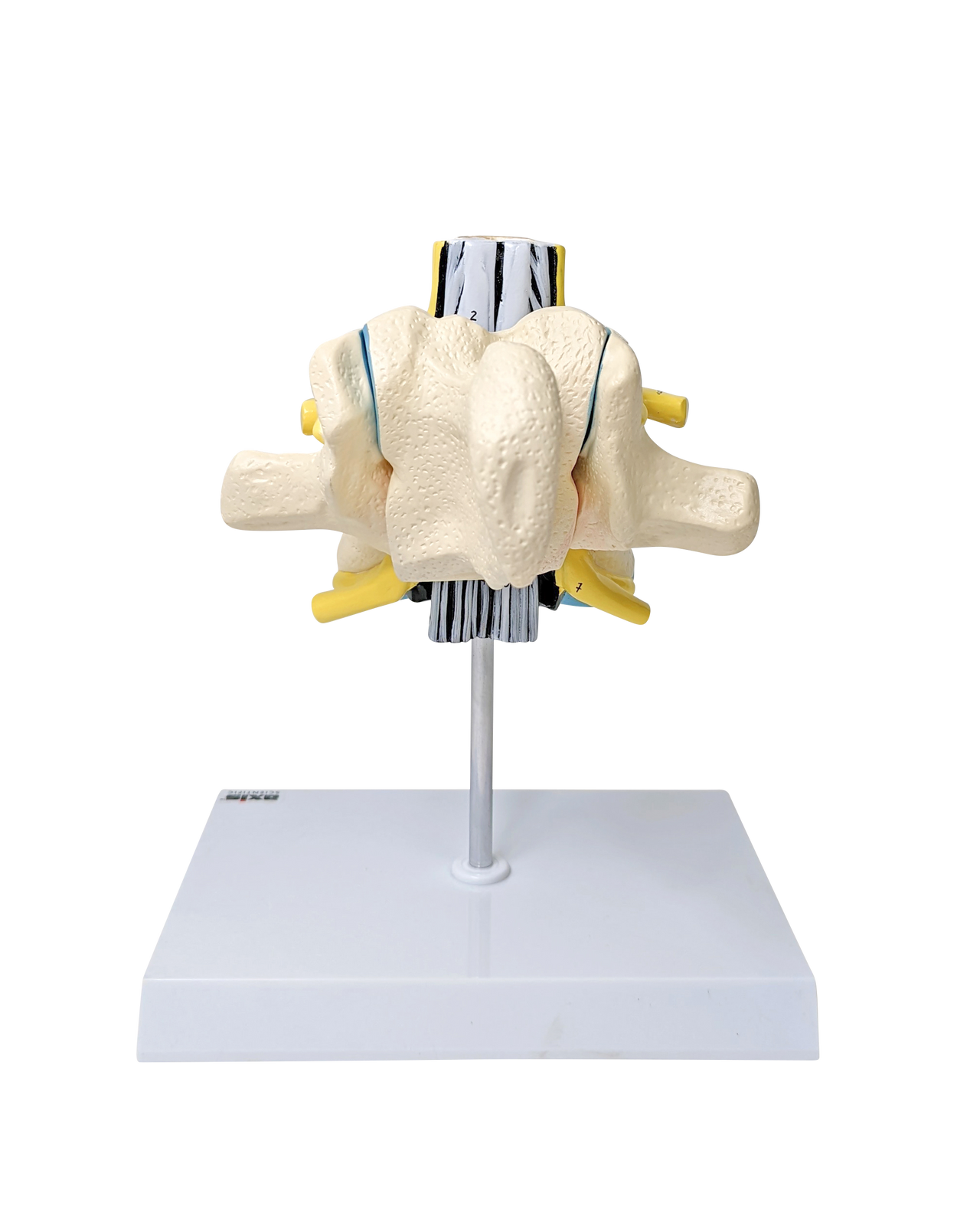 Axis Scientific Enlarged Lumbar Vertebrae with Spinal Cord and Nerves