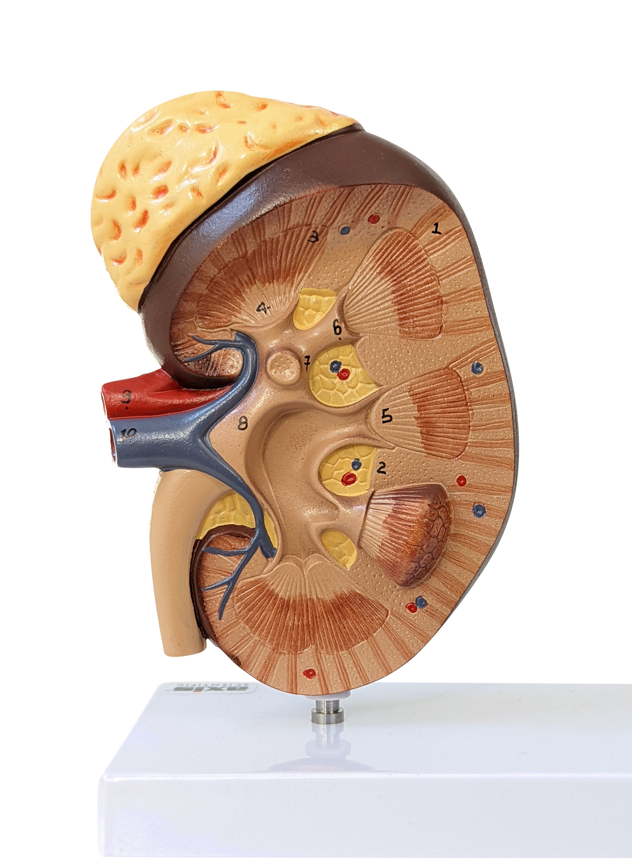 Axis Scientific Kidney Model with Nephrons and Glomerulus (Kidney)