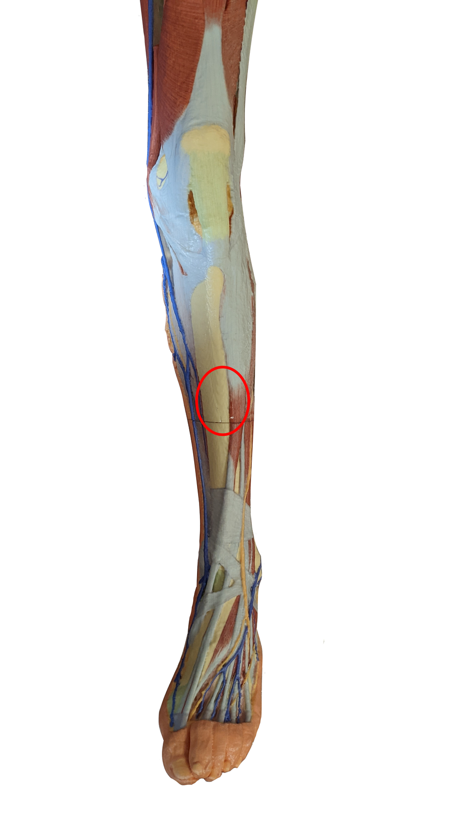 3D Printed Lower Limb - Superficial Dissection with Male Left Pelvis - Used, Sold As-Is