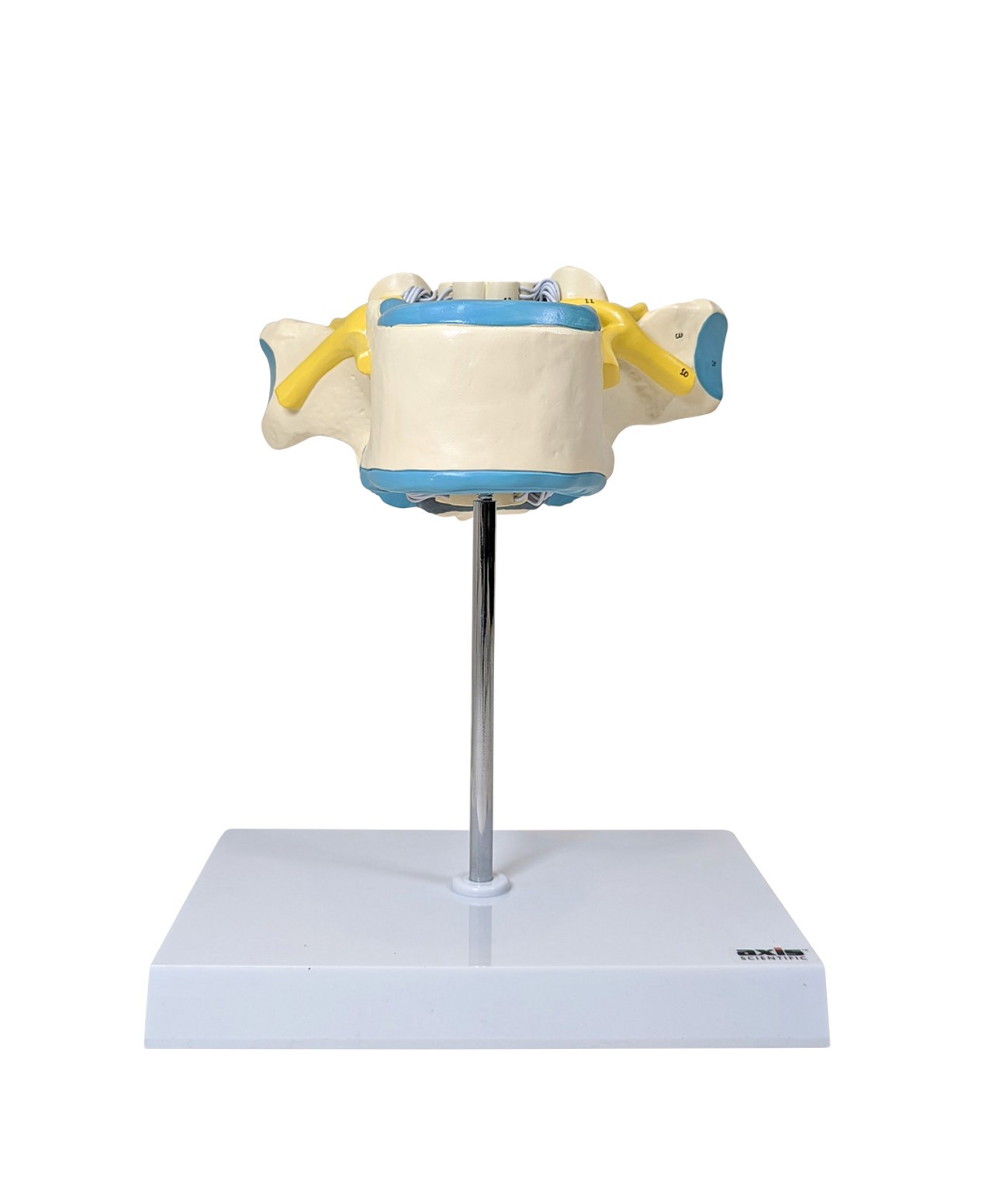Axis Scientific Enlarged Cervical Vertebrae with Spinal Cord and Nerves