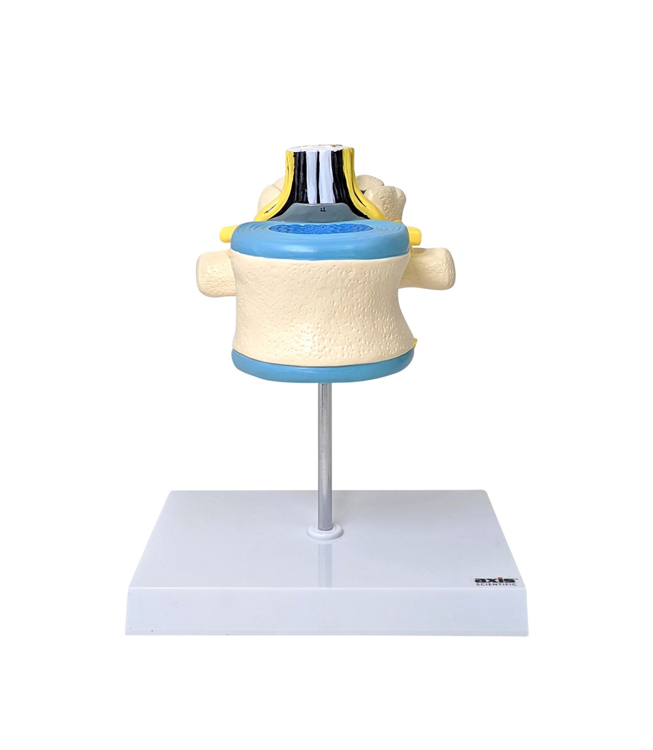 Axis Scientific Enlarged Lumbar Vertebrae with Spinal Cord and Nerves