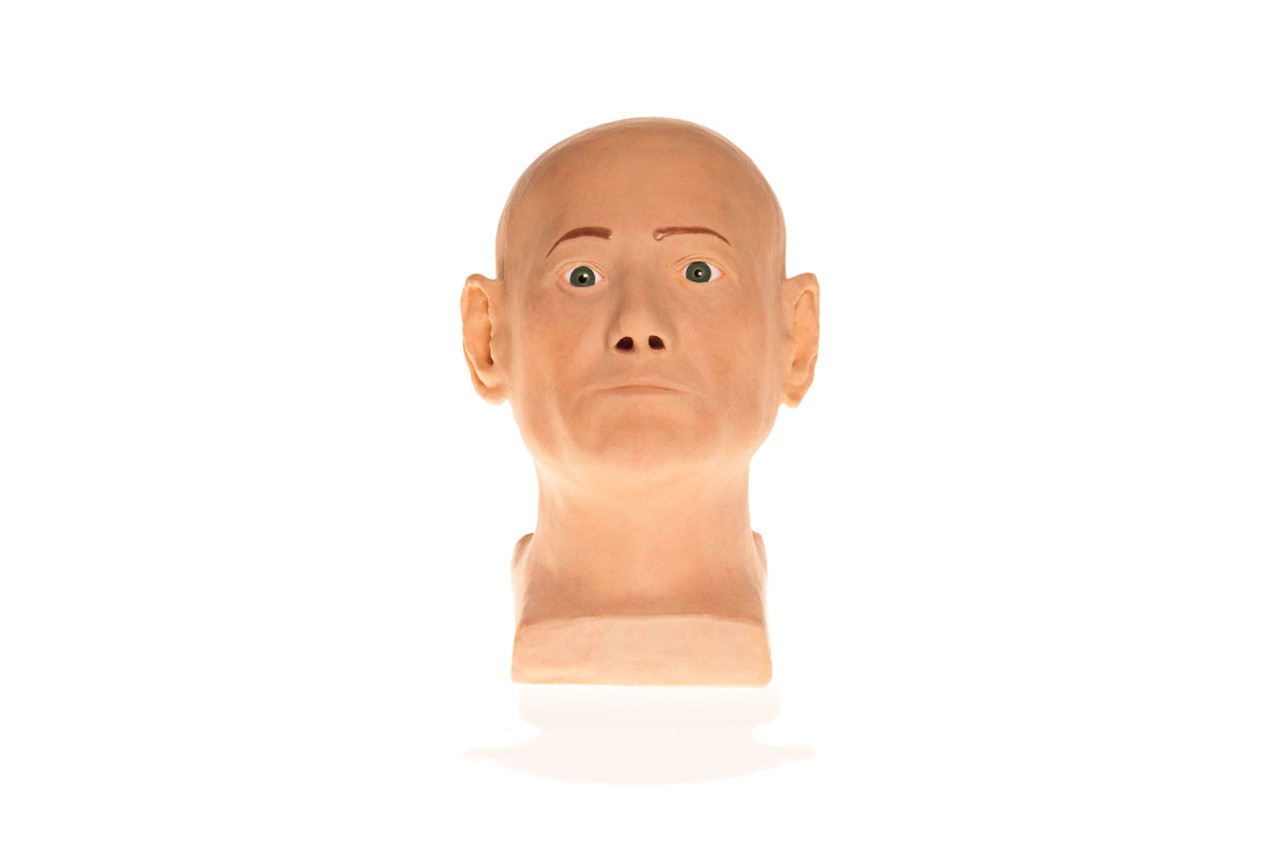 SimSkin Basic IL Duomo Head Cosmetic Training Model with Tumors