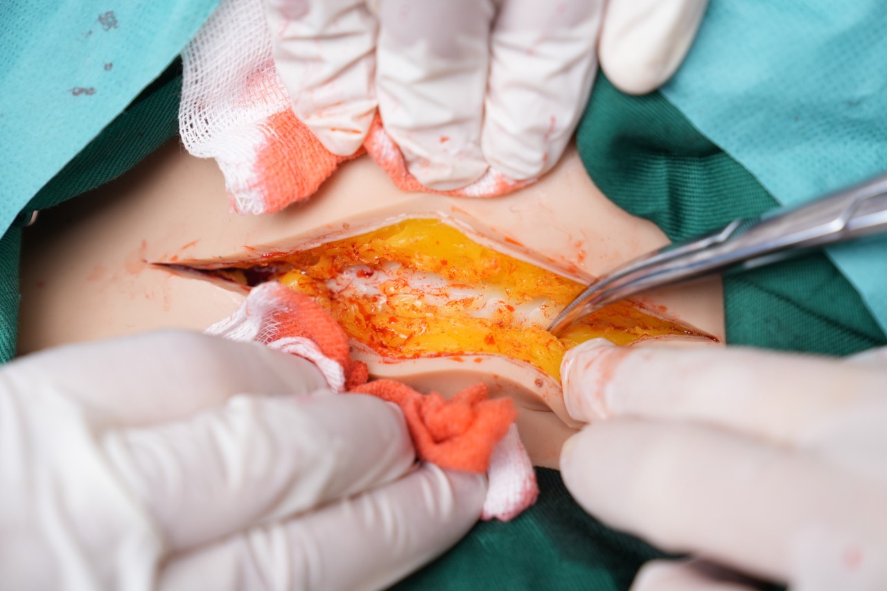 Anatomy Lab Wearable C-Section Simulator - Fat Incision