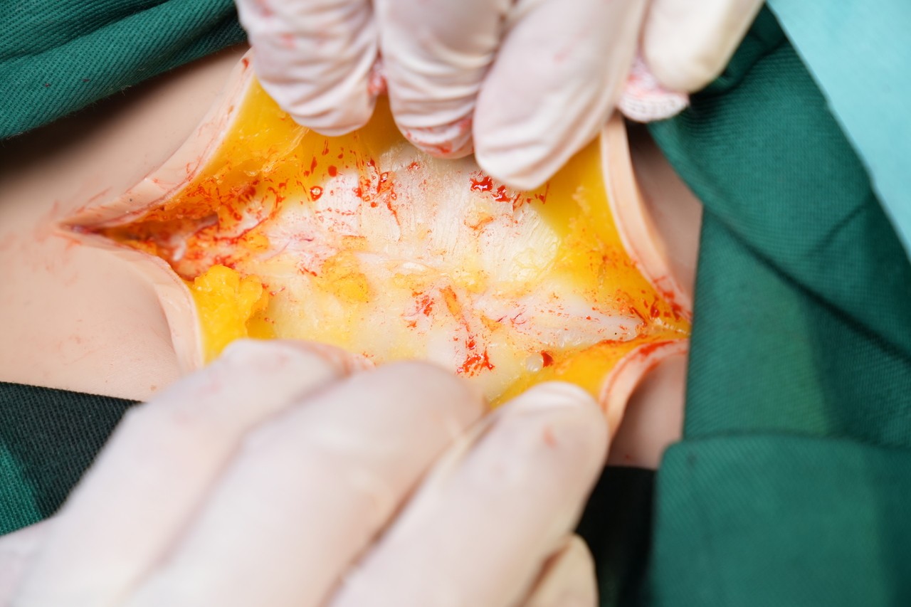 Anatomy Lab Wearable C-Section Simulator - Fat Incision Open
