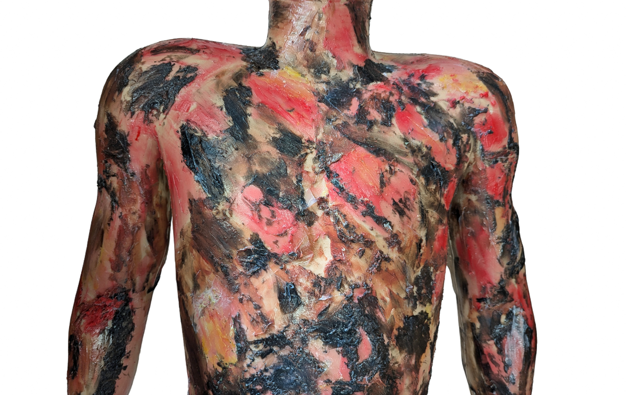 Anatomy Lab Full-Body Burn Assessment Manikin