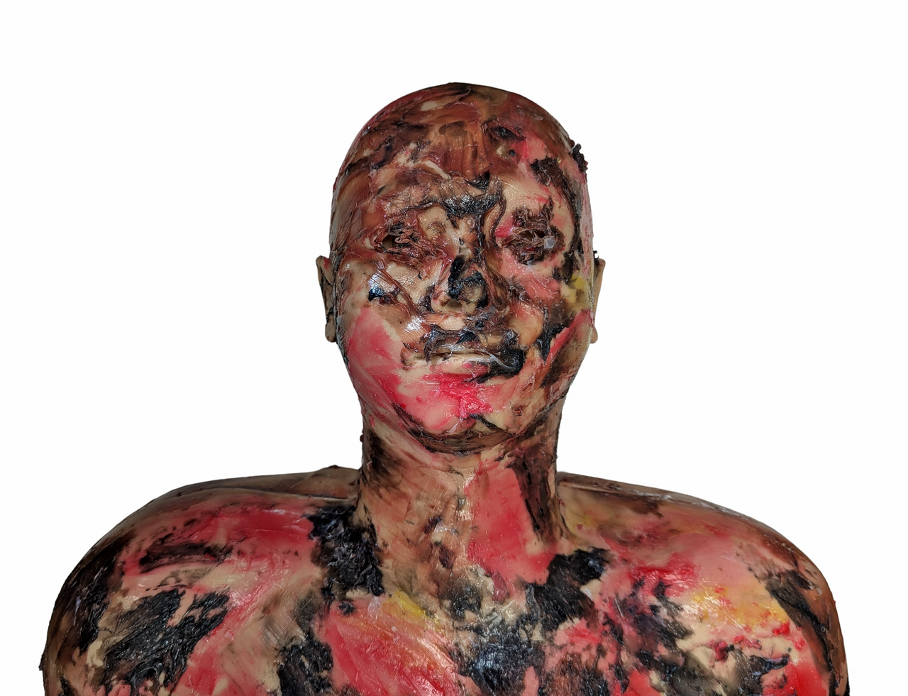 Anatomy Lab Full-Body Burn Assessment Manikin