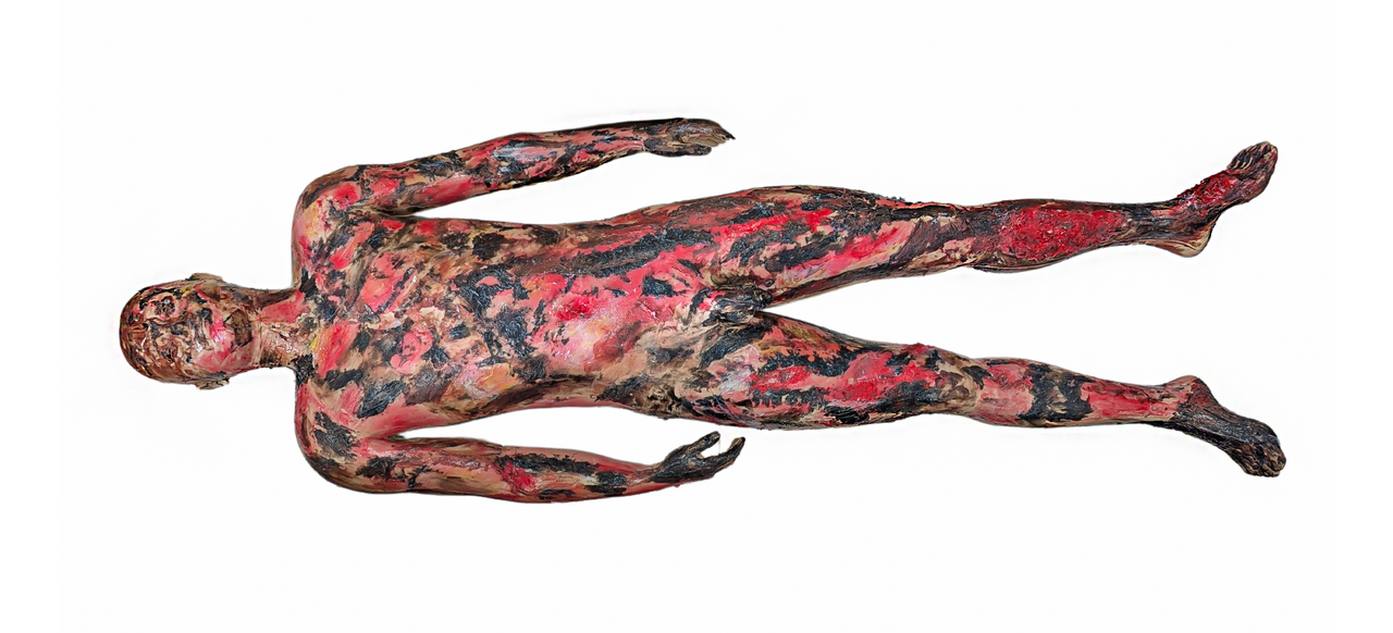 Anatomy Lab Full-Body Burn Assessment Manikin