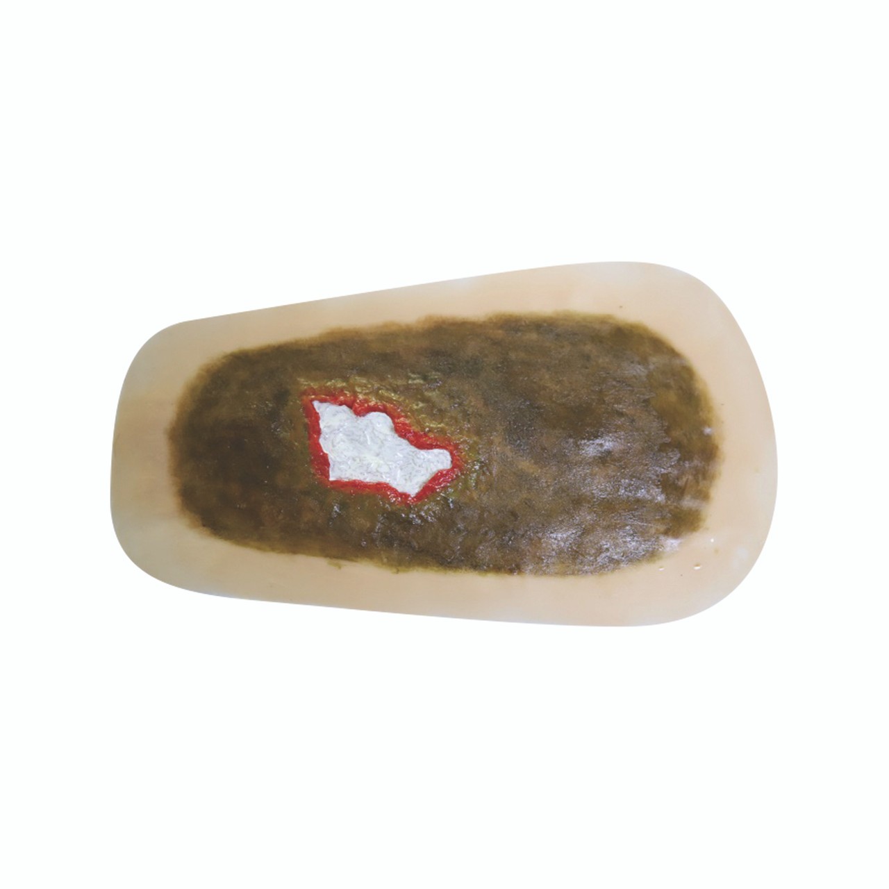 Anatomy Lab SP Moulage for TCM - Ecthyma module