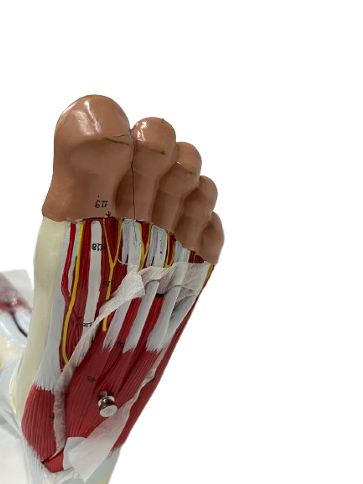 Crack on bottom of foot