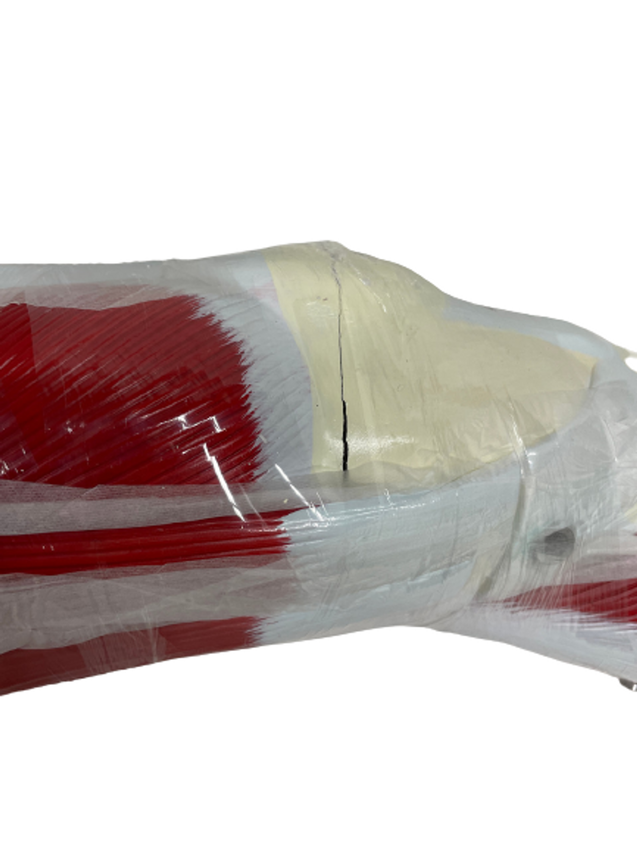 Closeup of right-side view of cracked knee
