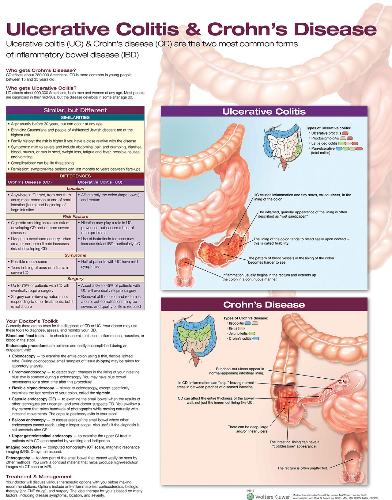 Ulcerative Colitis & Crohn's Disease Anatomical Chart - Laminated