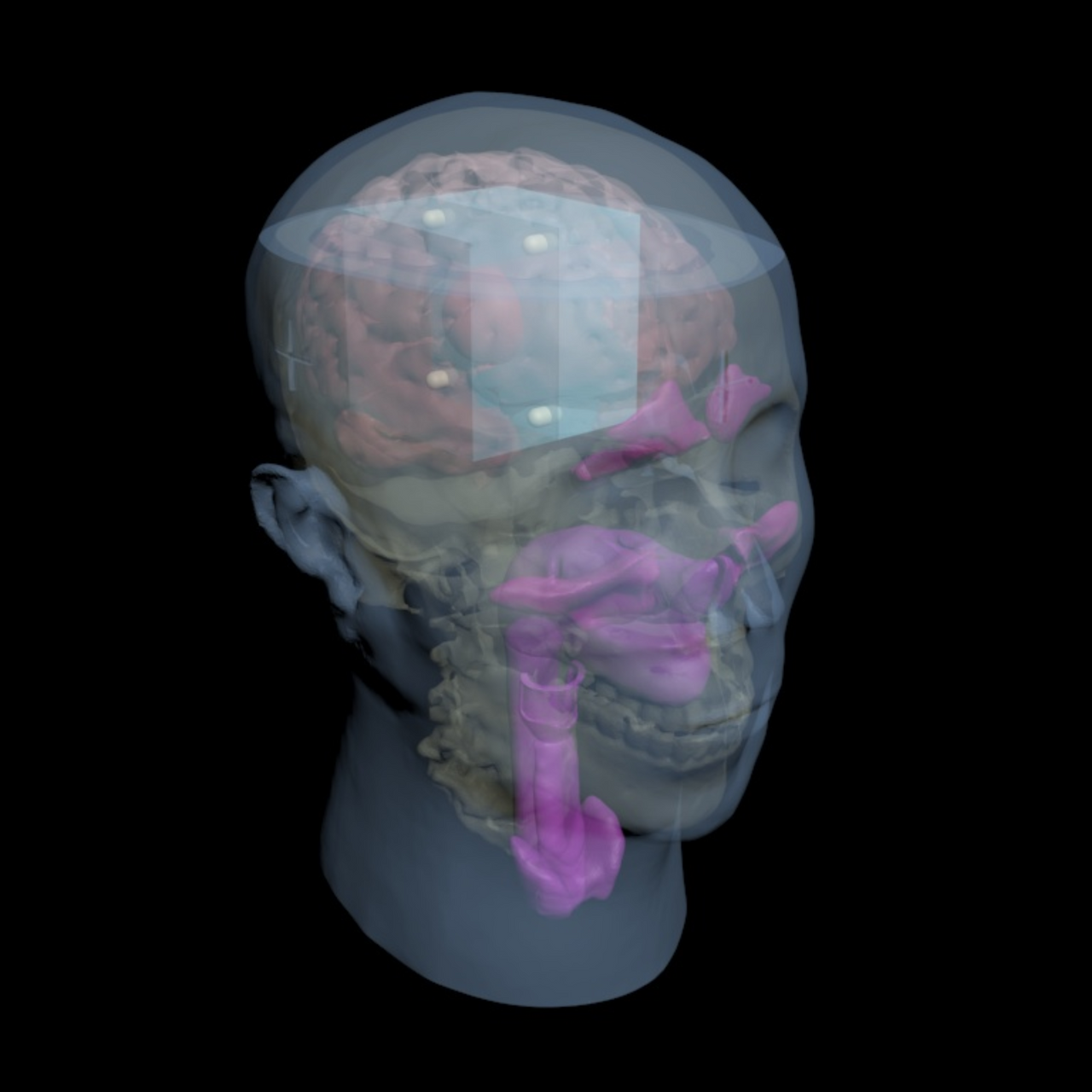 Adult Head QC1 for X-Ray CT and MRI Phantom Model