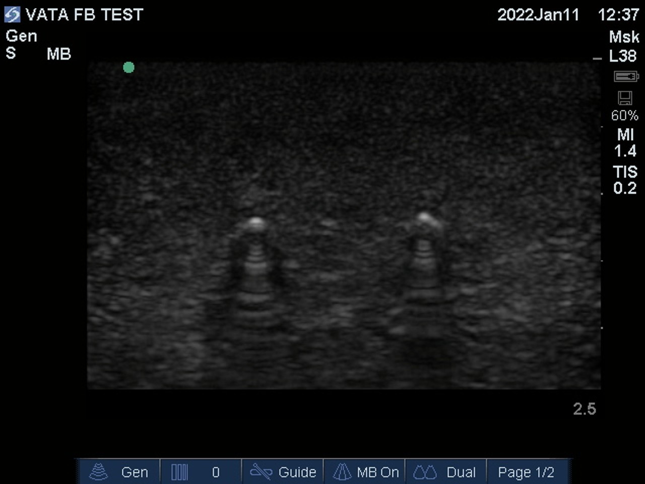 Ultrasound Phantom Foreign Body, Lightly Pigmented