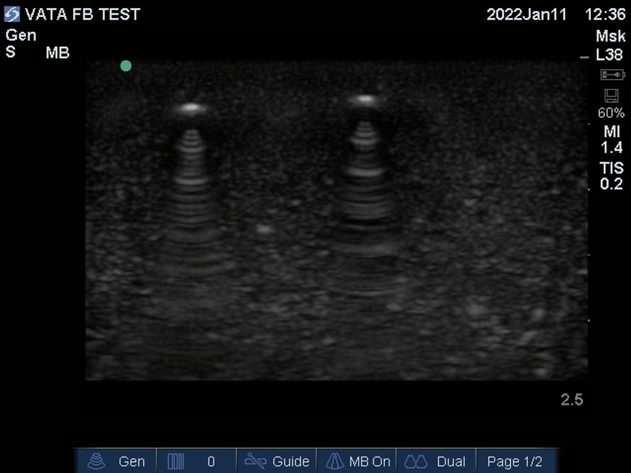 Ultrasound Phantom Foreign Body, Lightly Pigmented