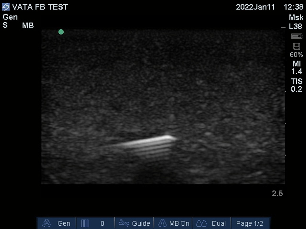 Ultrasound Phantom Image