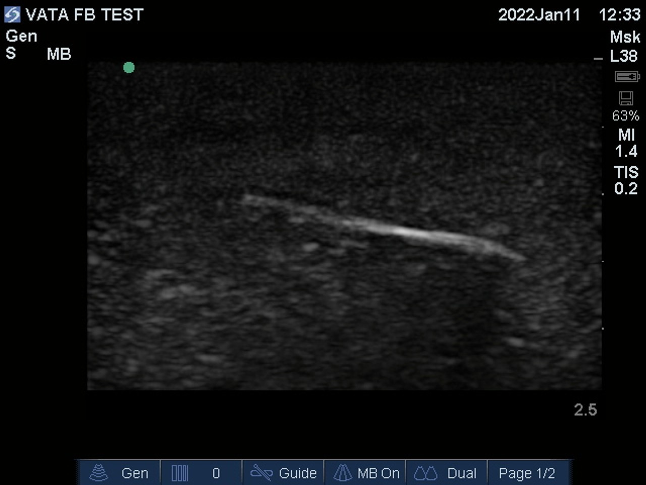 Ultrasound Phantom Image
