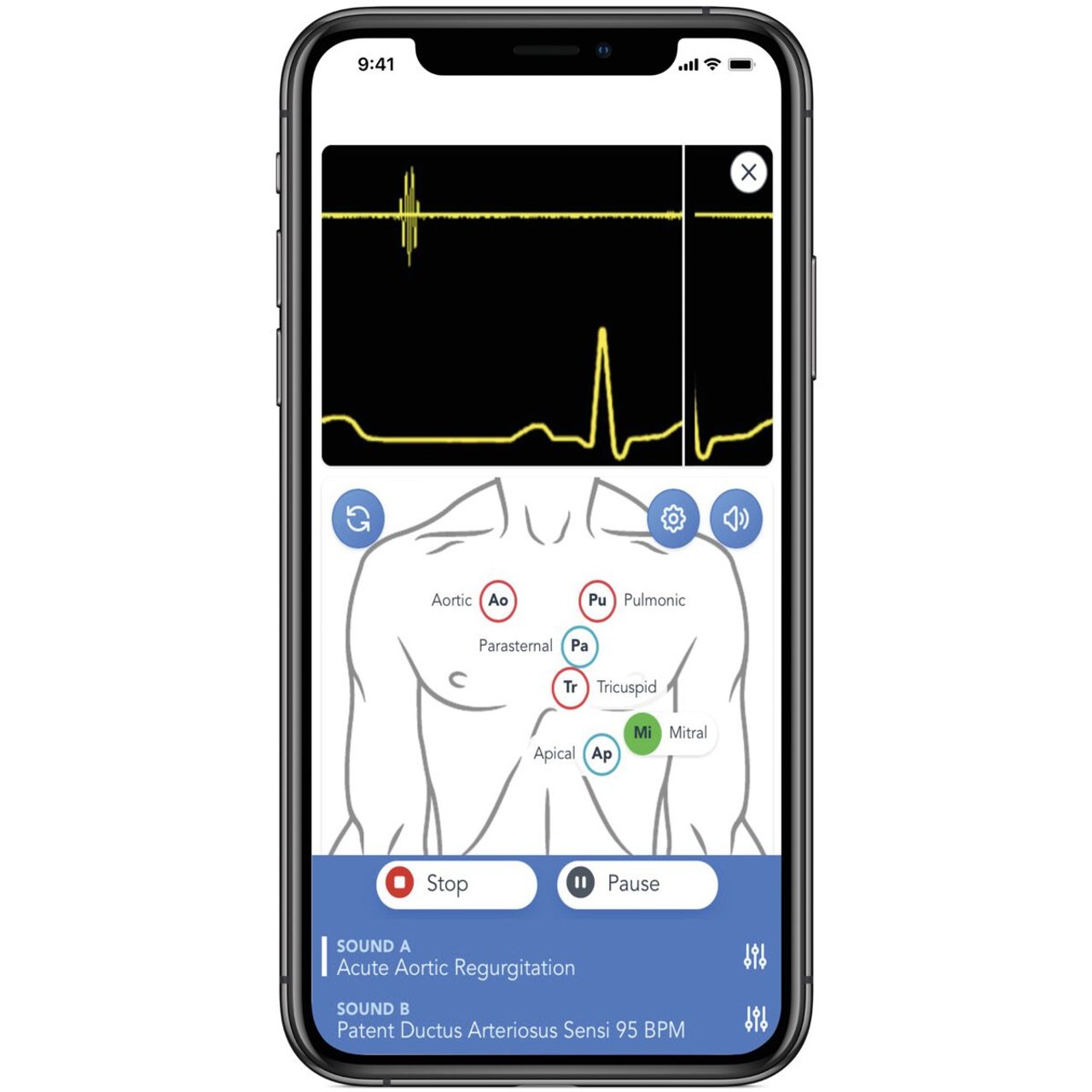 SAM4 Adult Auscultation Manikin, Dark Skin