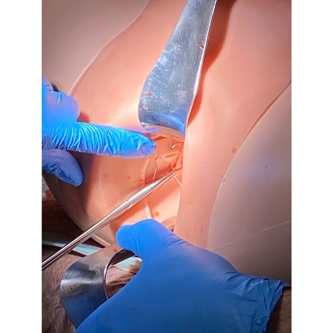 Postpartum Hemorrhage Simulator  PPH Trainer Pro