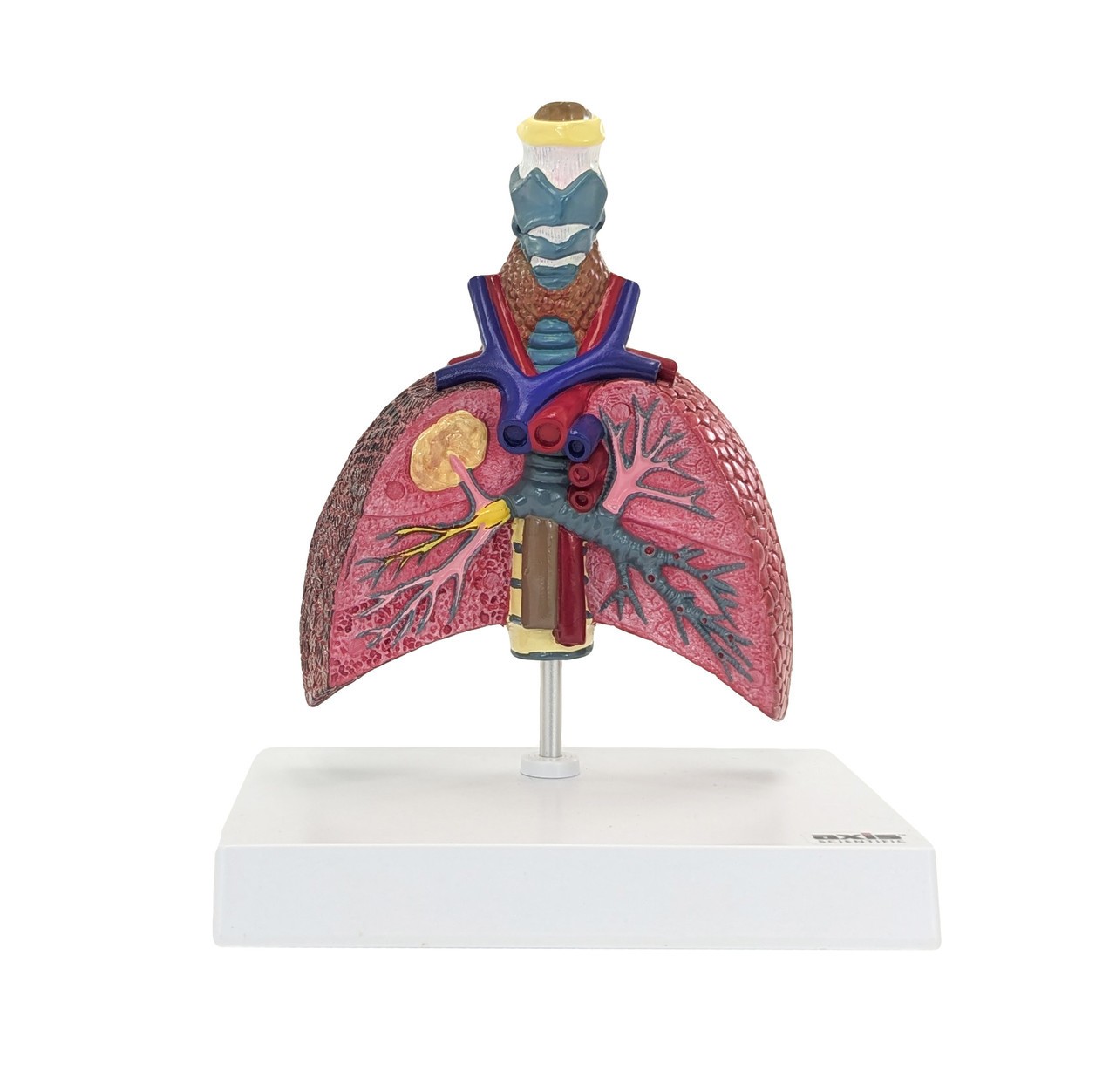 Axis Scientific Respiratory System With Pathologies, 5-Parts