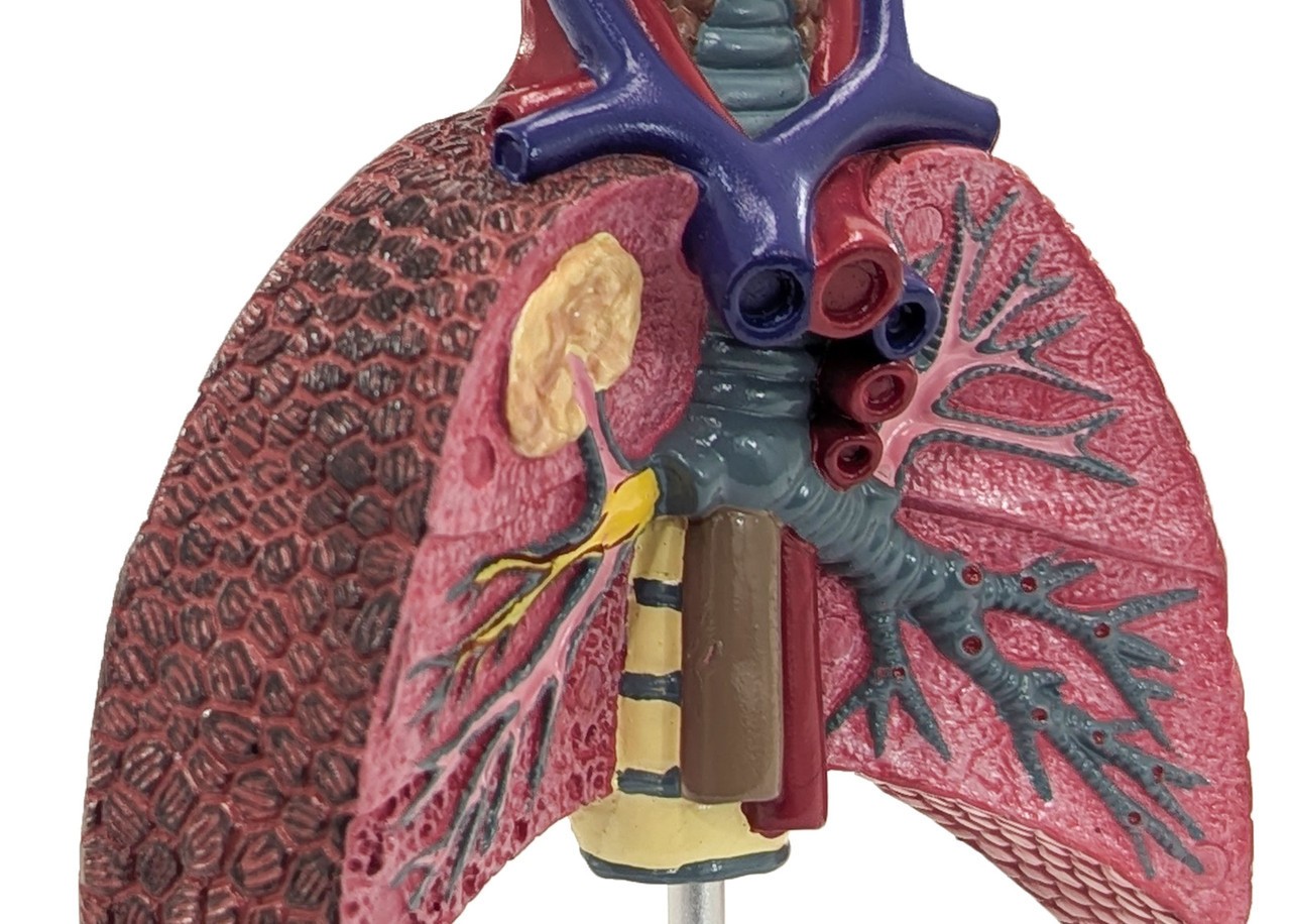 Axis Scientific Respiratory System With Pathologies, 5-Parts