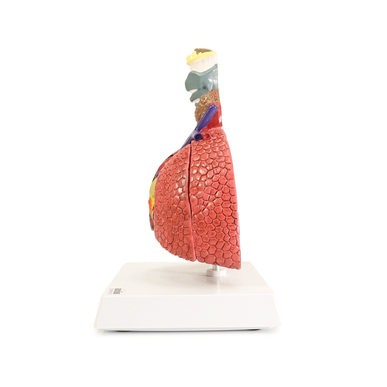 Axis Scientific Respiratory System With Pathologies, 5-Parts