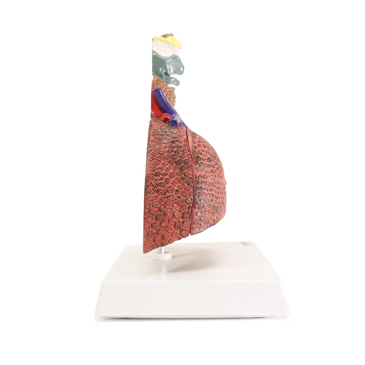 Axis Scientific Respiratory System With Pathologies, 5-Parts