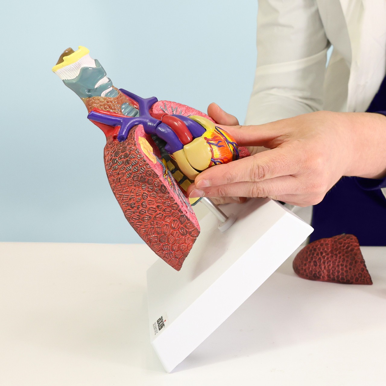 Axis Scientific Respiratory System With Pathologies, 5-Parts