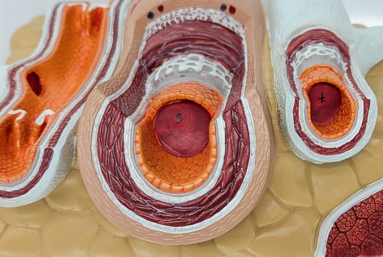 Axis Scientific Enlarged Artery and Vein Anatomy Model