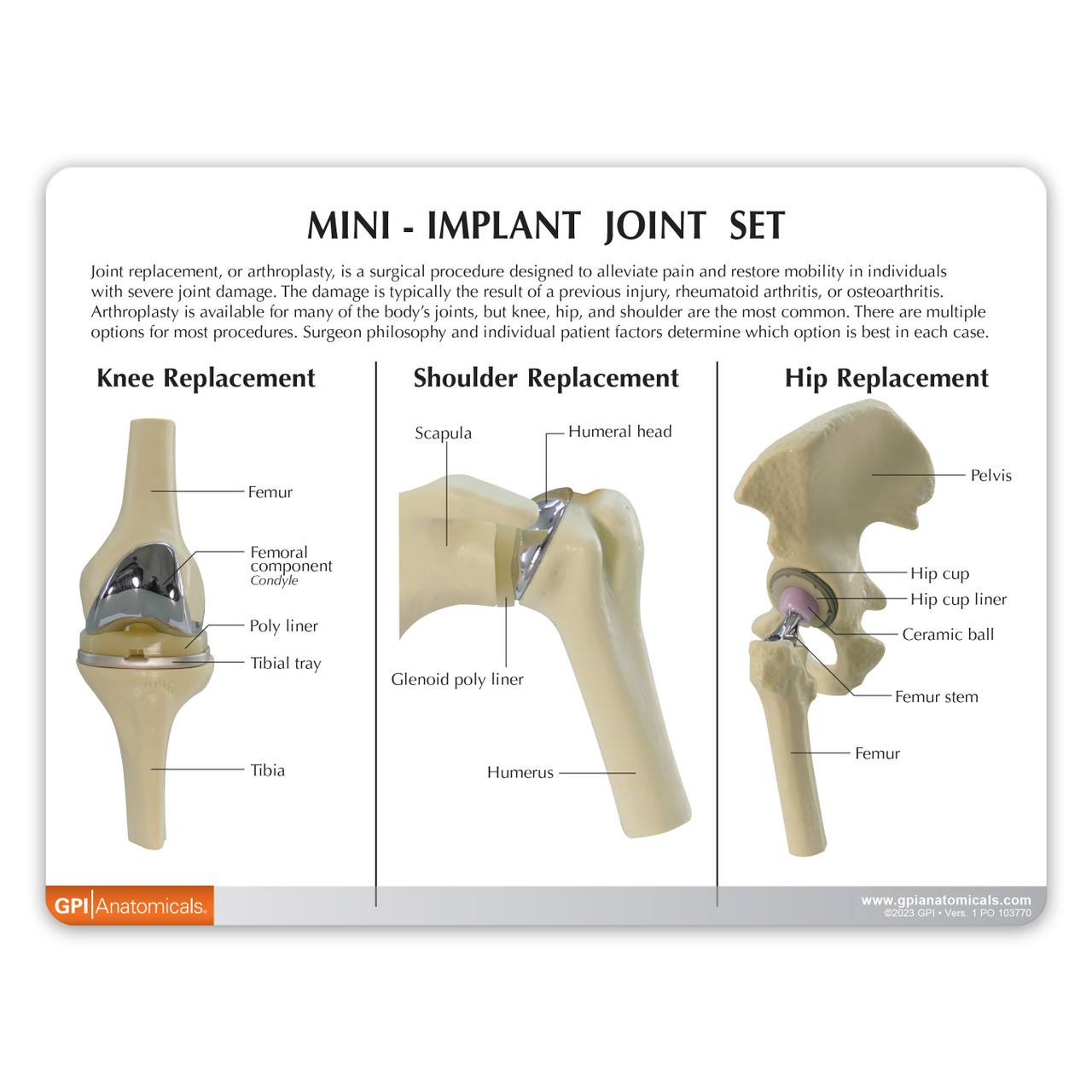 Mini Implant Joint Anatomy Model Set Front of Key Card