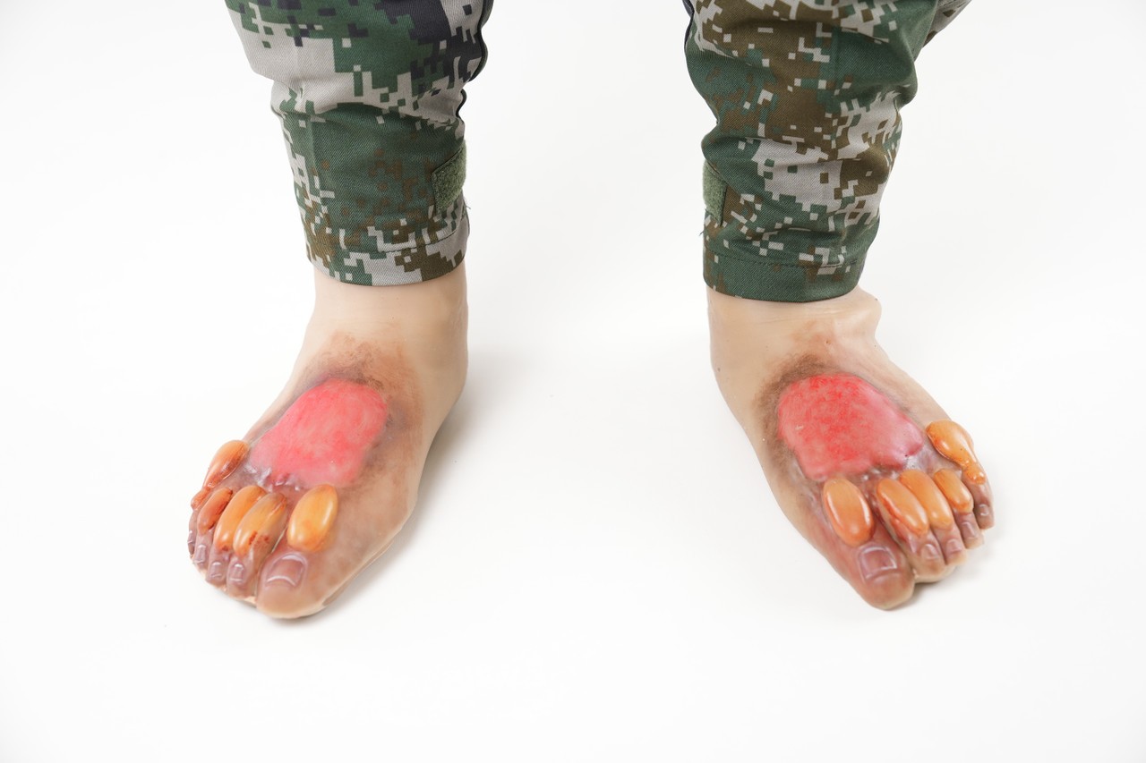The Anatomy Lab Wearable Burn Wound Kit provides realistic tactile and visual feedback in a multitude of training environments.