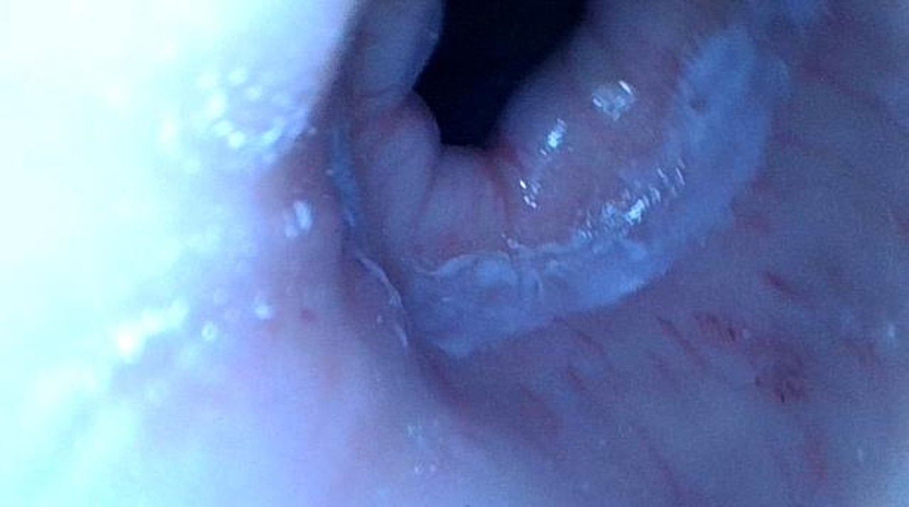 Upper GI Endoscopy Training Model