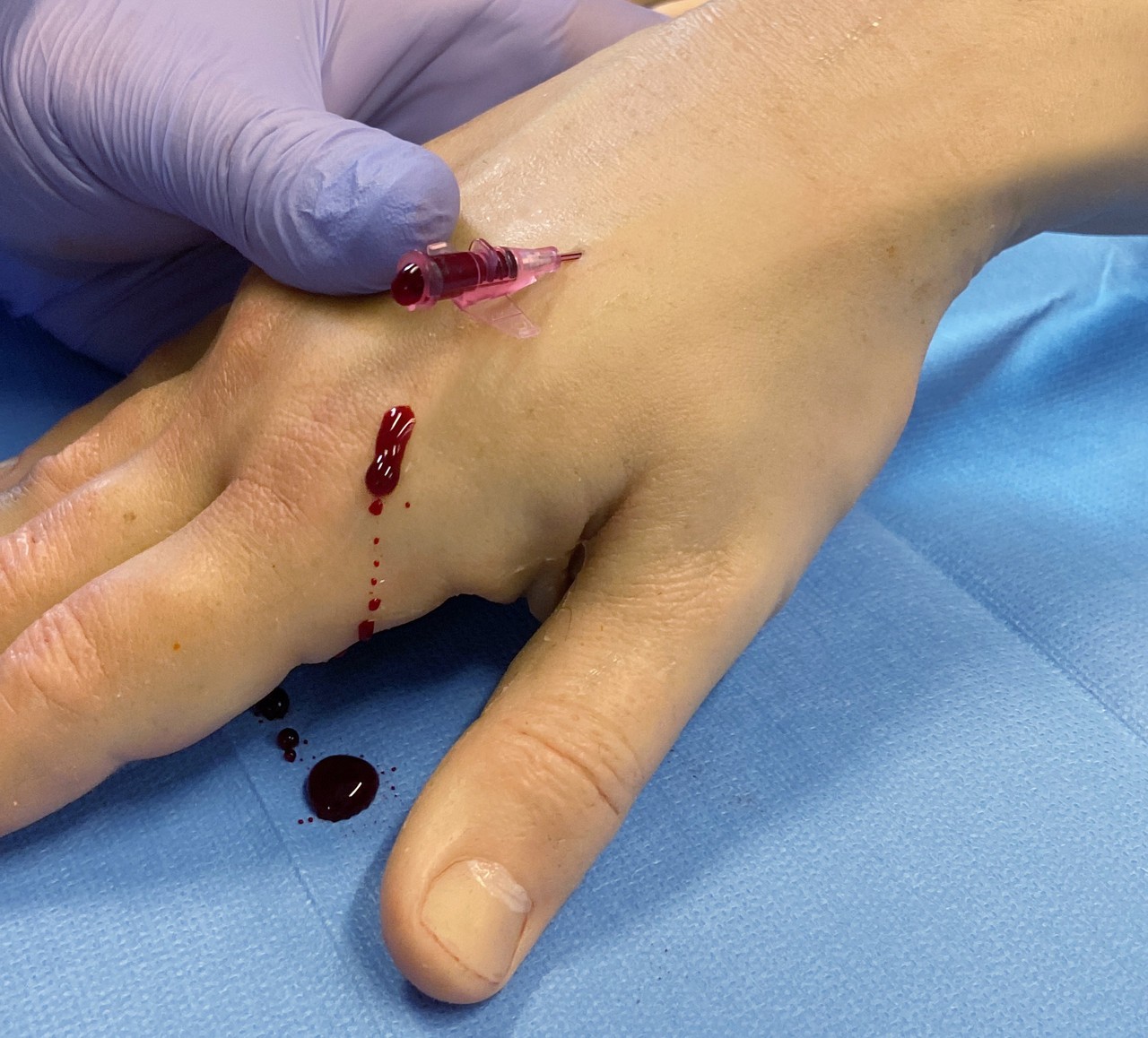 Puncture Pete Hyper Realistic I.V. Training Arm