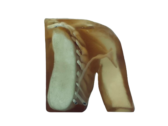 Adult Female Breast Phantom Model