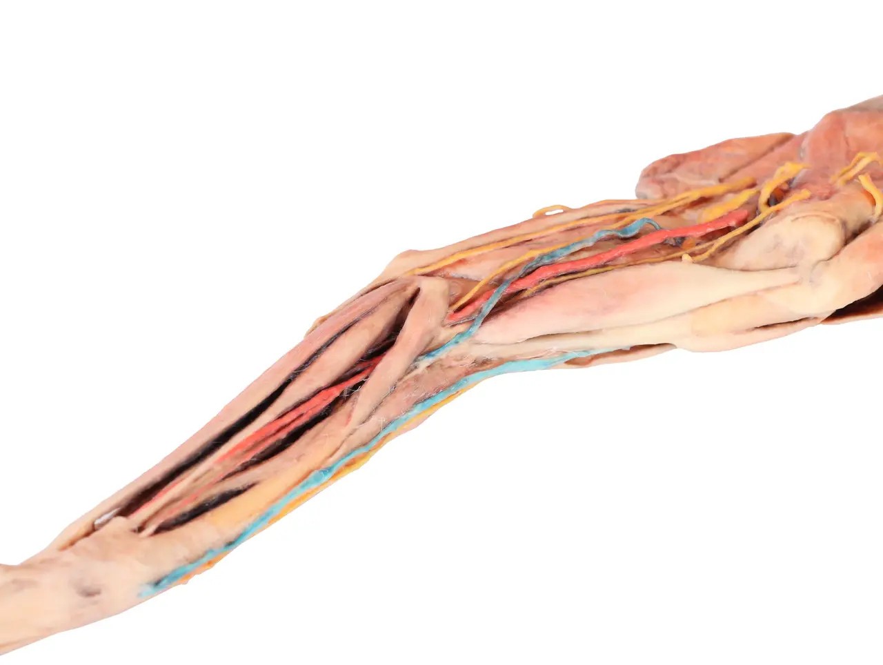 Muscle, Tendons, Ligaments, Vessels and Nerves Distal to the Elbow - Dog Forelimb vascular system view
