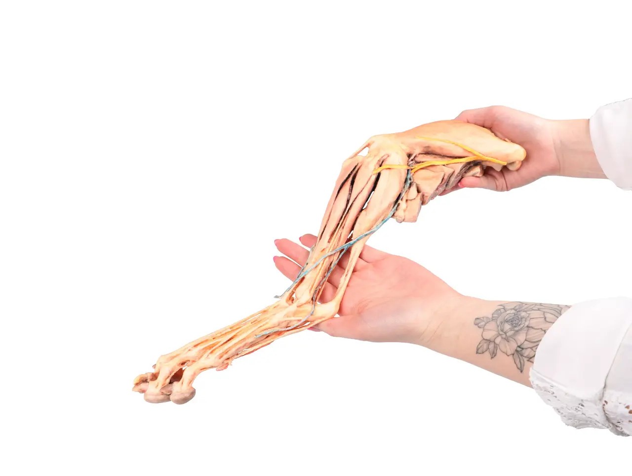Muscle, Tendons, Ligaments, Vessels and Nerves Distal to the Elbow - Dog Hindlimb scale from the left side