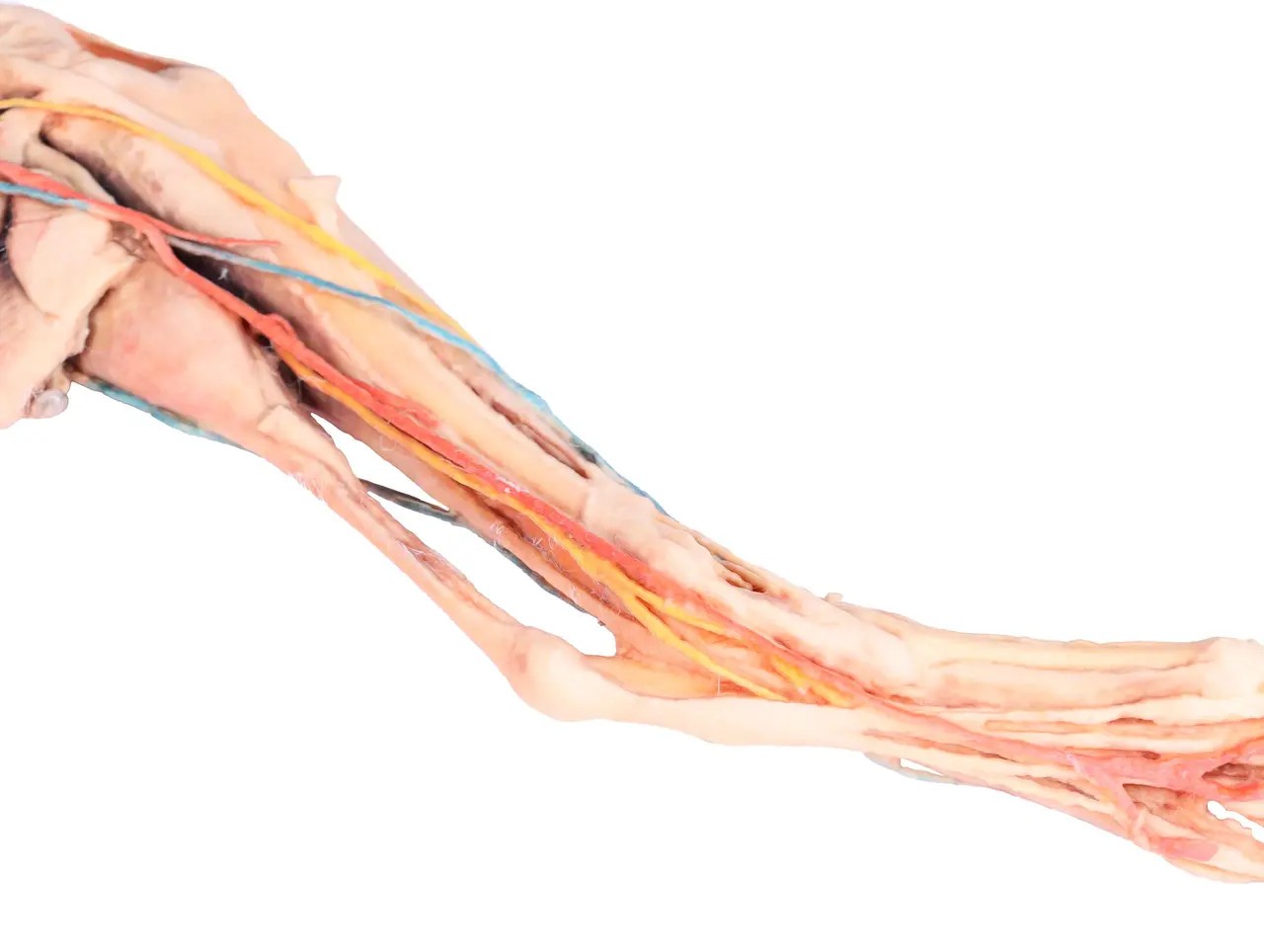 Muscle, Tendons, Ligaments, Vessels and Nerves Distal to the Elbow - Dog Hindlimb close up of middle leg from below