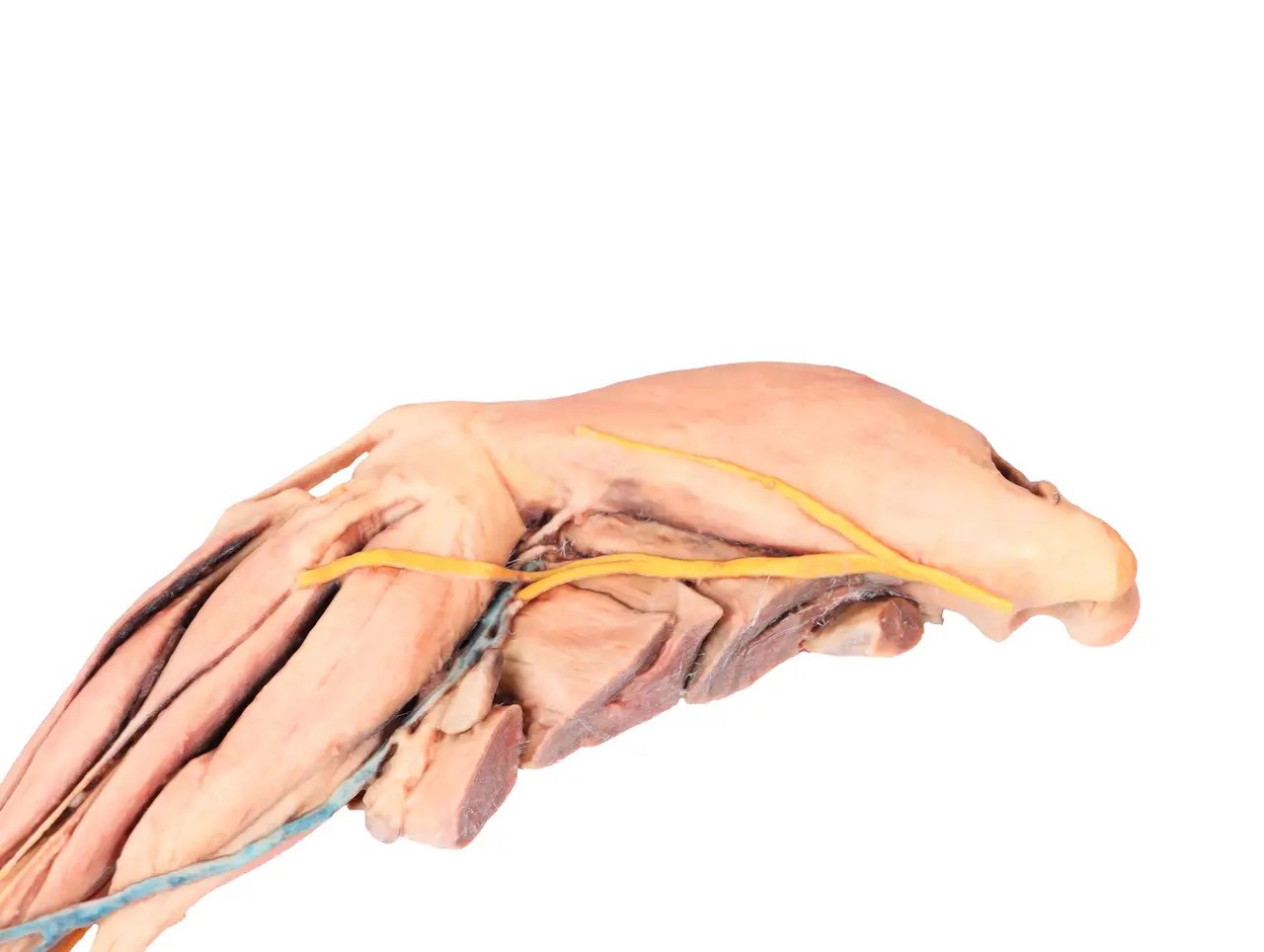 Muscle, Tendons, Ligaments, Vessels and Nerves Distal to the Elbow - Dog Hindlimb close up on upper hindlimb