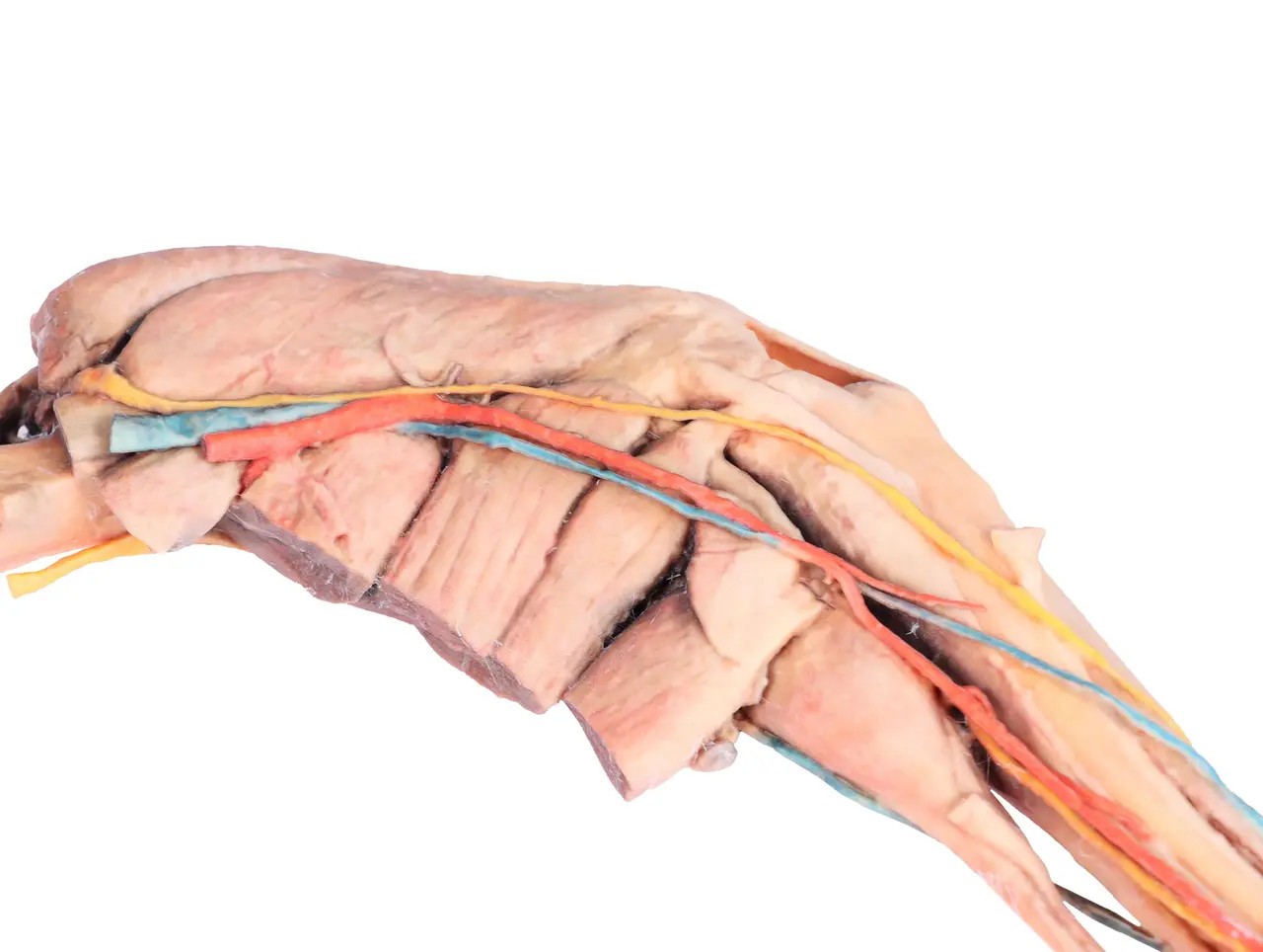 Muscle, Tendons, Ligaments, Vessels and Nerves Distal to the Elbow - Dog Hindlimb close up of hind leg from the right side
