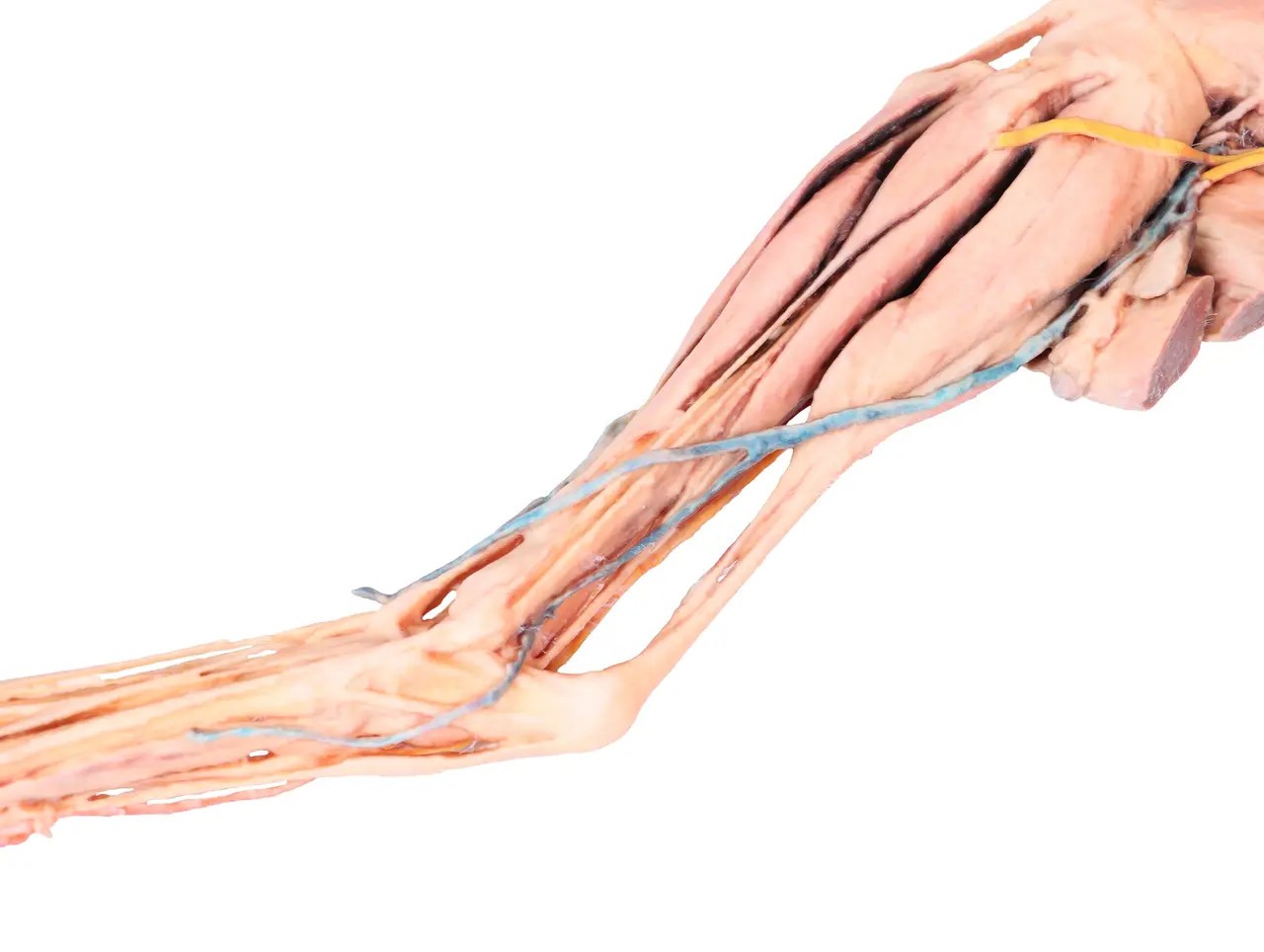 Muscle, Tendons, Ligaments, Vessels and Nerves Distal to the Elbow - Dog Hindlimb close up of middle leg