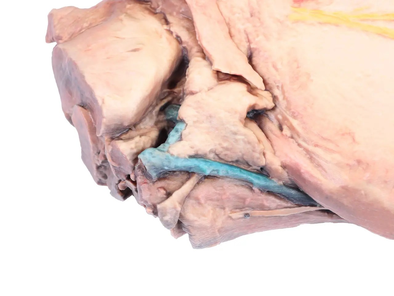 Horse Sagittal Half Head 3D Printed Model top view zoomed view of neck
