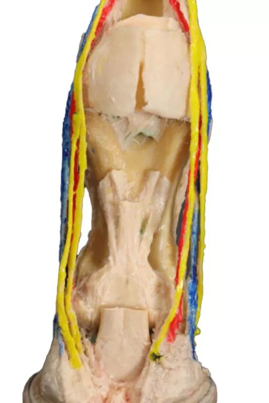 Deep Palmar Dissection - Horse Foot 3D Printed Model - close up view