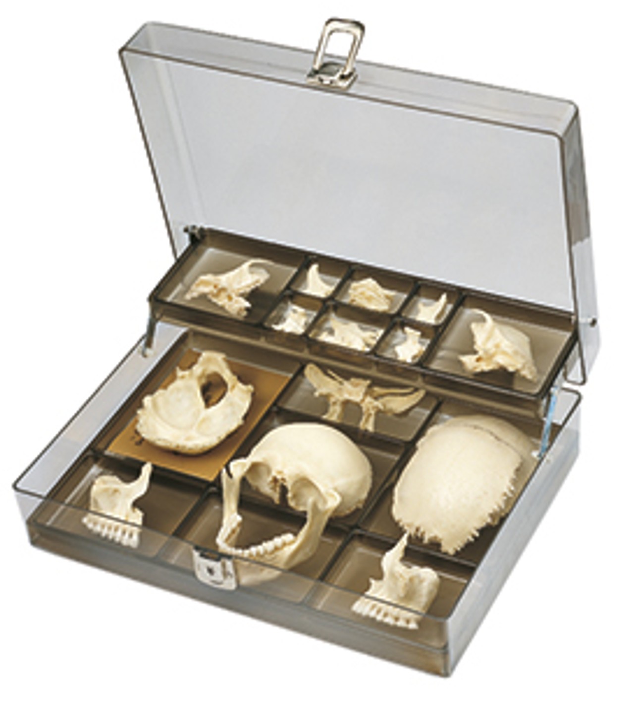SOMSO Beauchene Adult Human Skull in 22 Parts - Unmounted