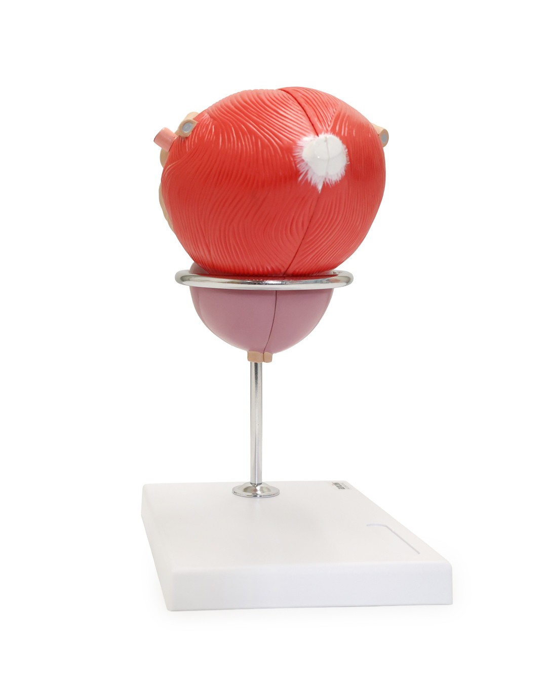 Axis Scientific Male Urinary Bladder with Prostate Numbered Anatomy Model, 2 Parts