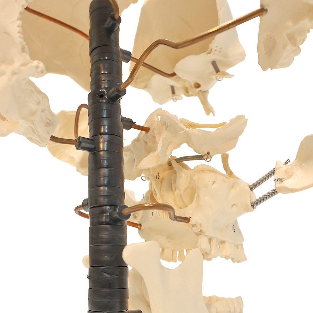 Axis Scientific Male Beauchene Skull Anatomy Model, 22 Parts